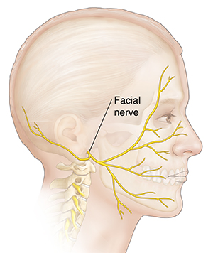 Side view of man's head showing facial nerve.