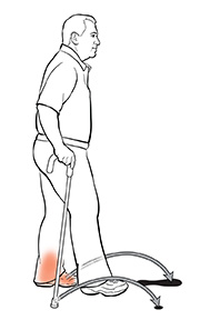 Man using cane, showing him put healthy leg forward while keeping affected leg and cane lined up with his body.