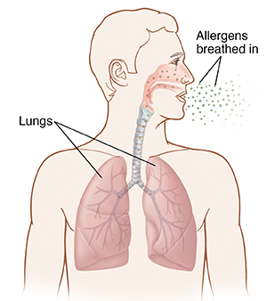 Head and chest showing allergens being breathed into lungs.