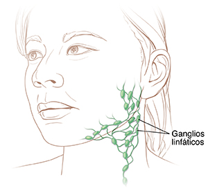 Vista tres cuartos de la cabeza de una mujer con ganglios linfáticos en el cuello