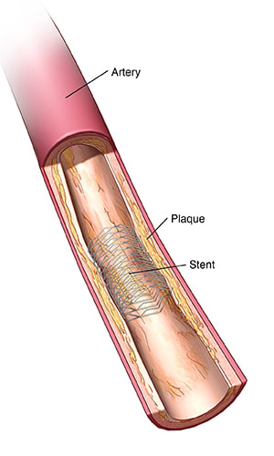 Content Health Encyclopedia URochester Medicine